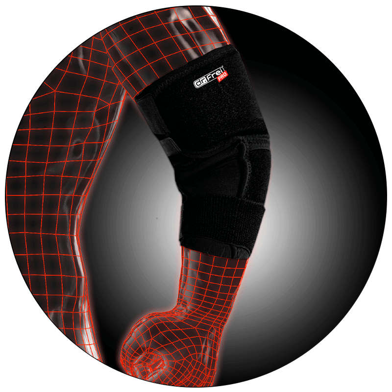 ELBOW BRACE WITH ADDITIONAL FIXATION